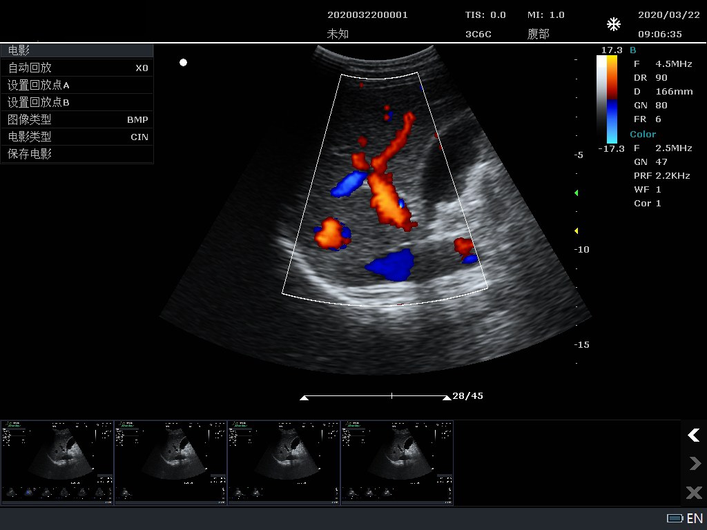Liver BC-mode